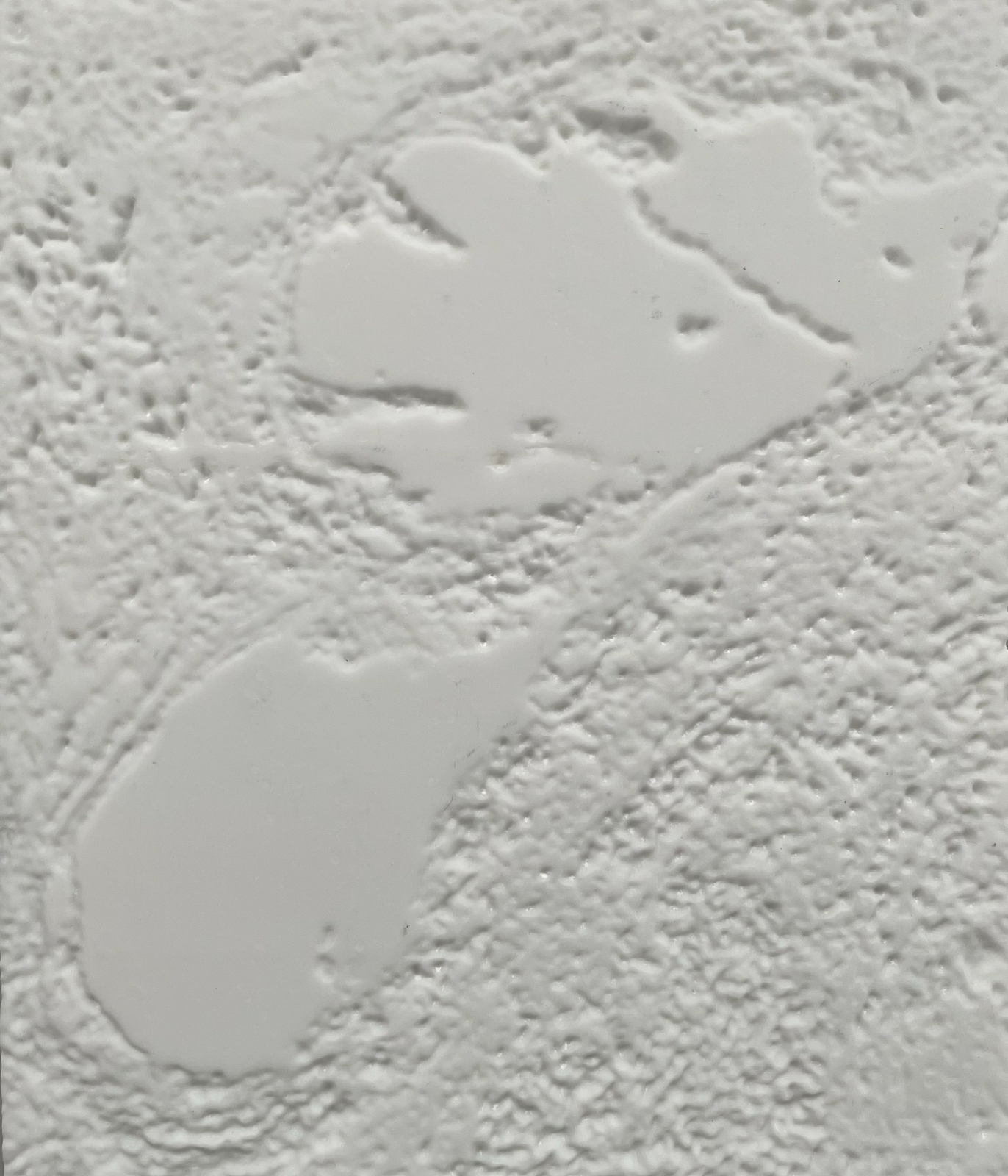 2025, veit krenn, tumorzellen