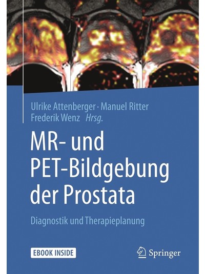Exlibris - MR- und PET-Bildgebung der Prostata