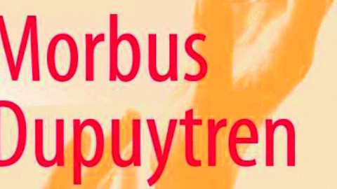 Morbus Dupuytren – Ein Patientenratgeber