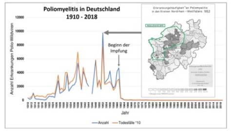 Interview - Vor 70 Jahren: Polioausbruch in NRW